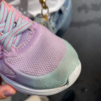 SKETCHERS'IN Ürün Kalitesizliği Ve Seri Müşteri Mağduriyeti