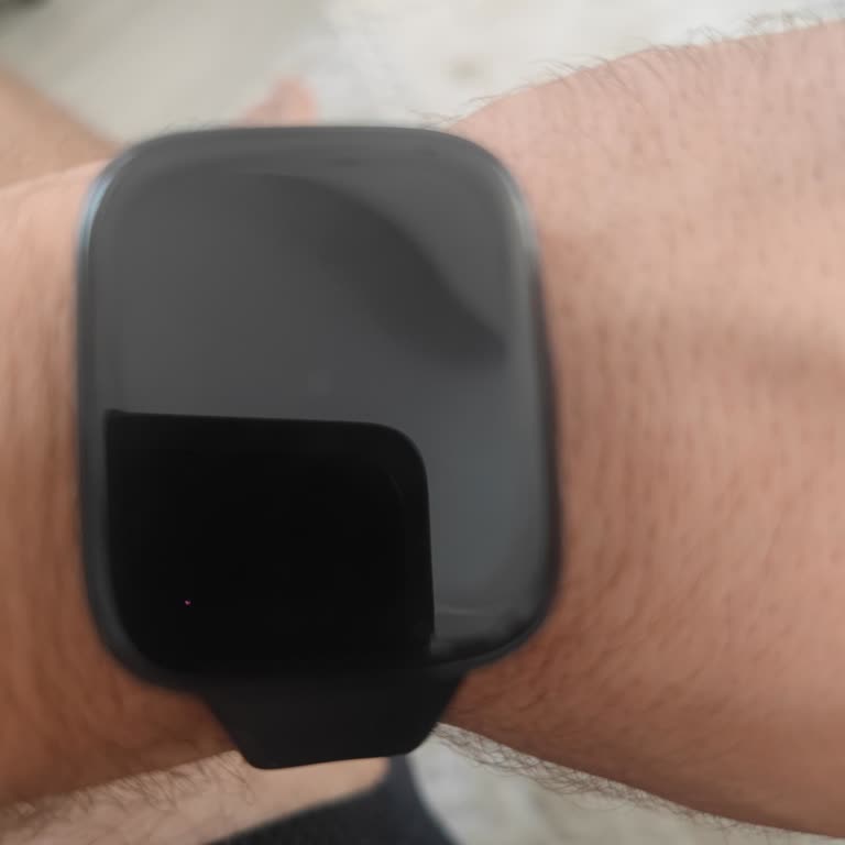 Xiaomi Yetkili Servis | Evofone Cihaza Bakmadan Geri Göndermişler!