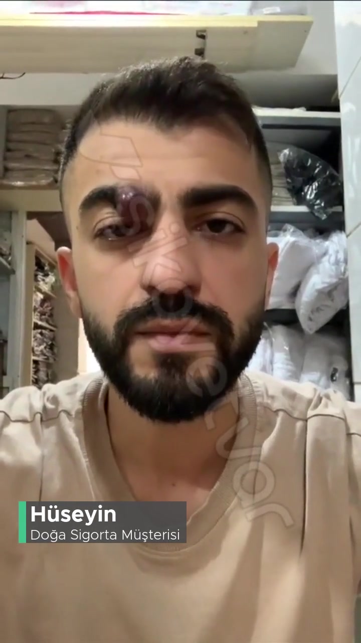 Doğa Sigorta Tamamlayıcı Sağlık Sigortasının İşlevsizliği videonun kapak resmi