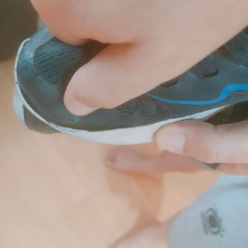 Skechers Ayakkabı İkisi De 3 Ayda Yırtıldı