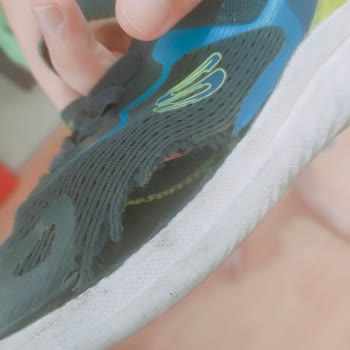 Skechers Ayakkabı İkisi De 3 Ayda Yırtıldı