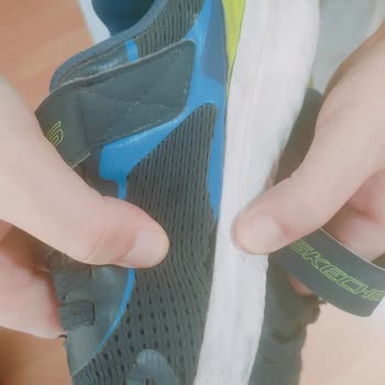 Skechers Ayakkabı İkisi De 3 Ayda Yırtıldı