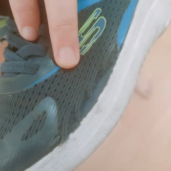 Skechers Ayakkabı İkisi De 3 Ayda Yırtıldı
