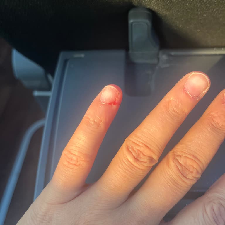 Düzce Terminalinde WC Başına Koydukları Kızın Tavrı