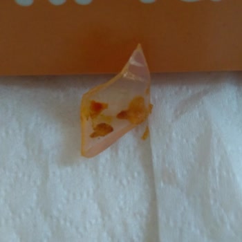 SD Döner Konya'daki Döner Dükkanında Yaşanan Sağlık Riski