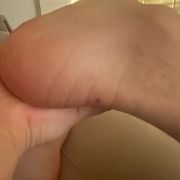 Ayakkabı Dünyası'ndan Aldığım Ayakkabı Ayağıma Vurdu