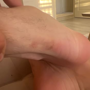 Ayakkabı Dünyası'ndan Aldığım Ayakkabı Ayağıma Vurdu