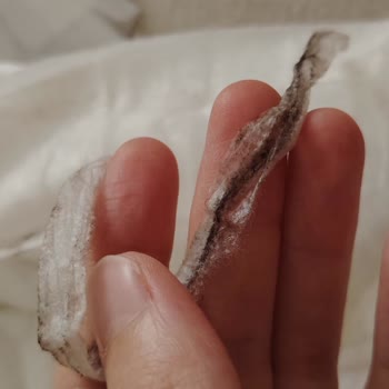 Molfix Yabancı Cisim Çıktı
