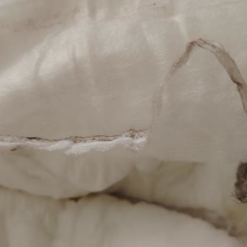 Molfix Yabancı Cisim Çıktı