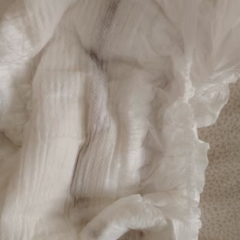 Molfix Yabancı Cisim Çıktı