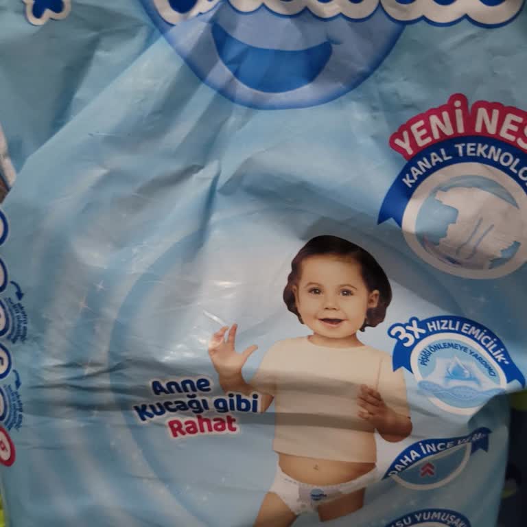 Molfix Bebek Bezinde Kalite Sorunu Ve Cilt Problemleri