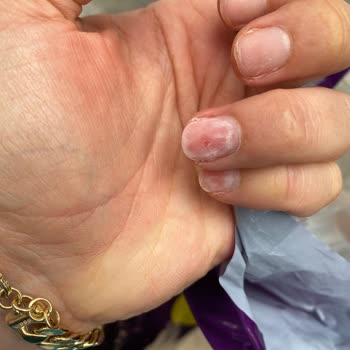 Eki aç