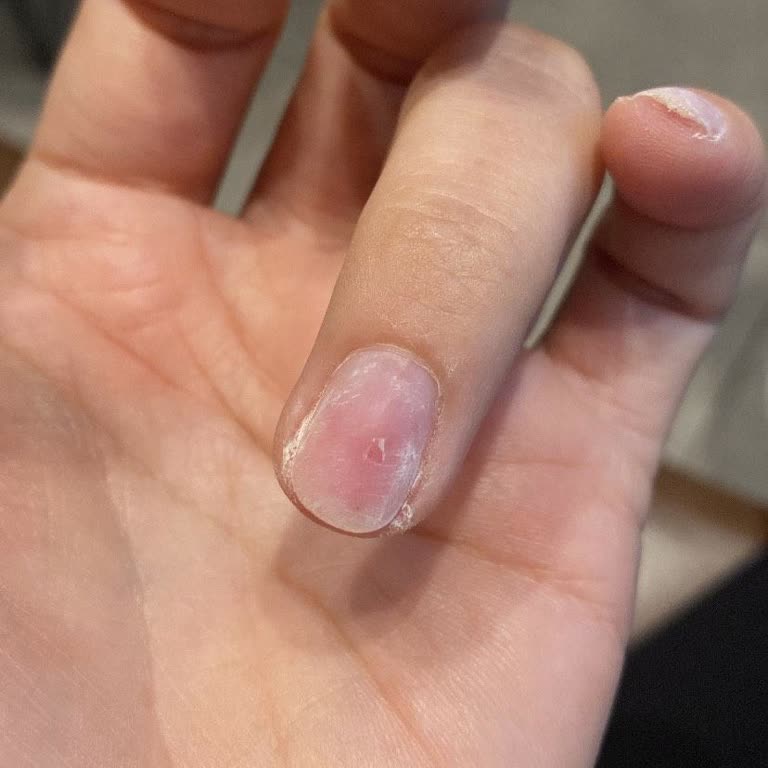 Nish Beauty Şişli Şubesi Tırnakçı Fiyaskosu