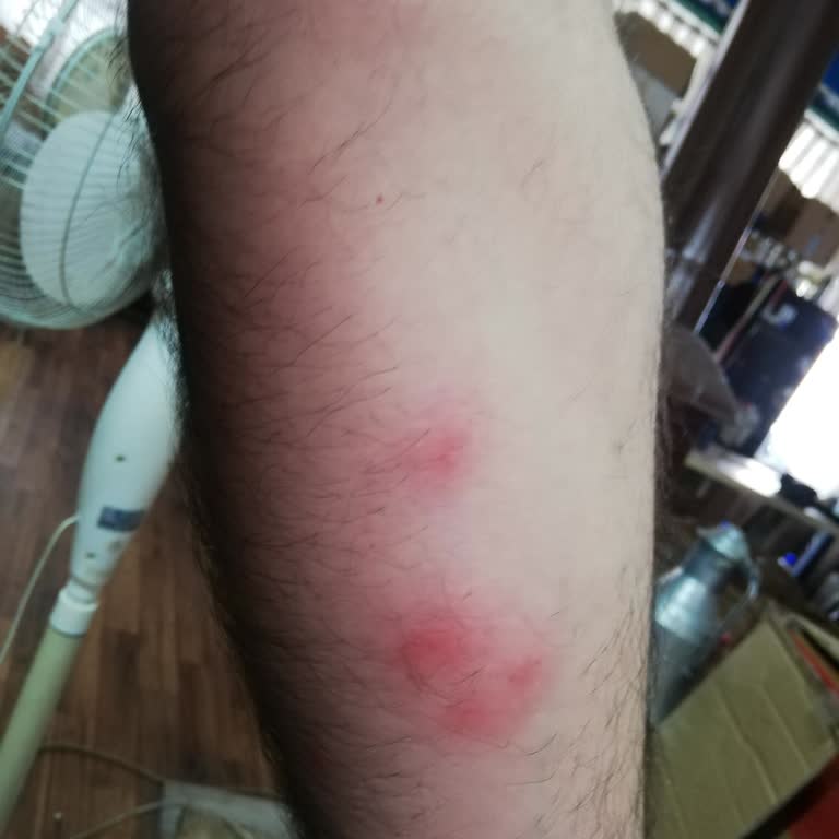 Kamil Koç Otobüsünde Böcek Ve Kaçırılma.