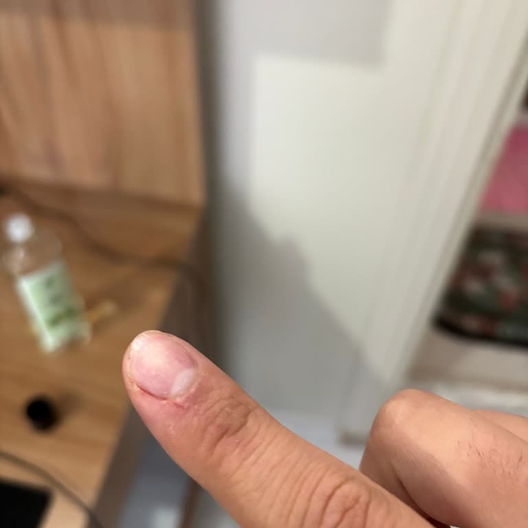 Sağlık Bakanlığı Kuduz Aşısı Bulunmuyor