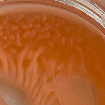 Jowe Kaş Sabitleyicisi Bozuldu