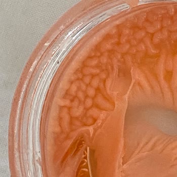 Jowe Kaş Sabitleyicisi Bozuldu