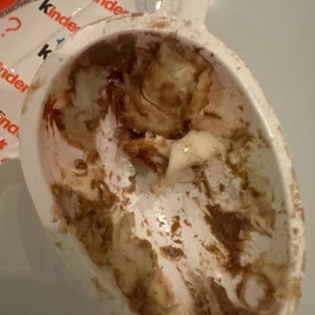 Kinder Sürpriz Yumurta Hayatı Tehlike
