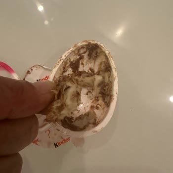 Kinder Sürpriz Yumurta Hayatı Tehlike