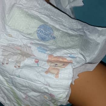 Molfix Bez Bant Defosu