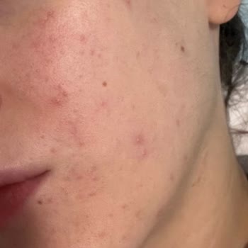 Garnier C Vit Yüz Yıkama Jeli Pişmanım