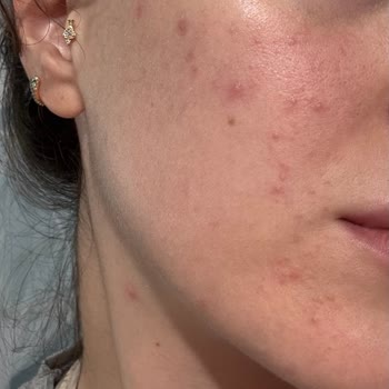 Garnier C Vit Yüz Yıkama Jeli Pişmanım