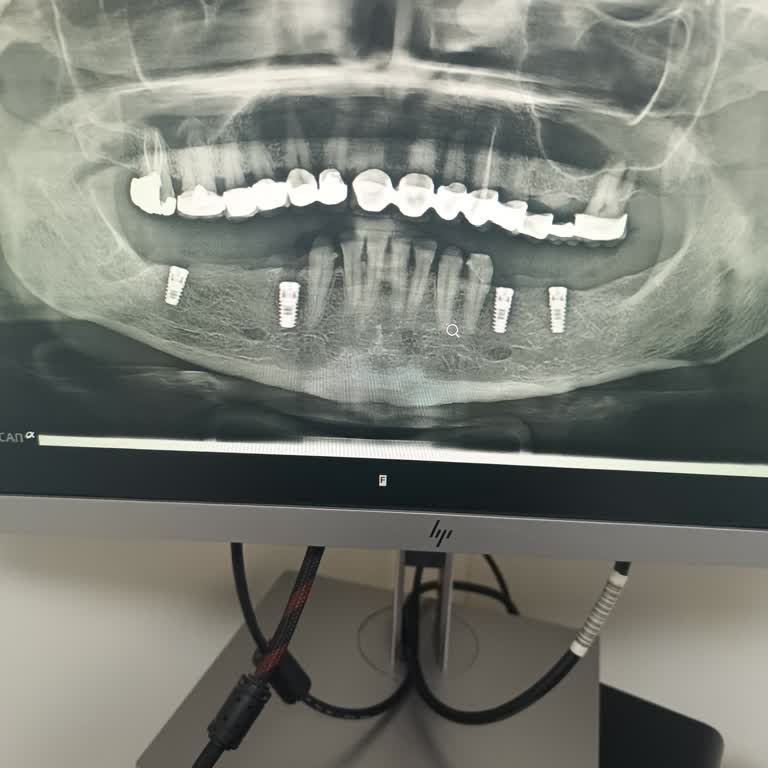 Egemen Esen Diş Kliniği Tedaviler İçin Gittim Ayrılmış.