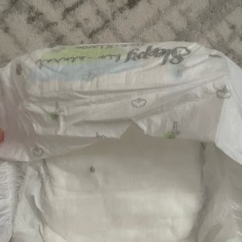 Sleepy Bebek Bezinde Yabancı Cisim