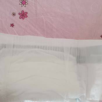 Molfix Bebek Bezinde Fabrika Çıkışı Bant Var.