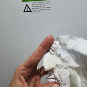 Molfix Bez Defolu Çıktı, Üstelik Fark Etmesek Zarar Verecek