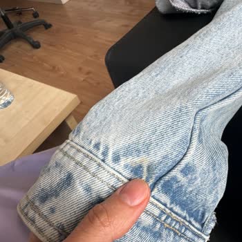 Mavi Marka Kot Gömleğimde Sarı Lekeler Oluyor