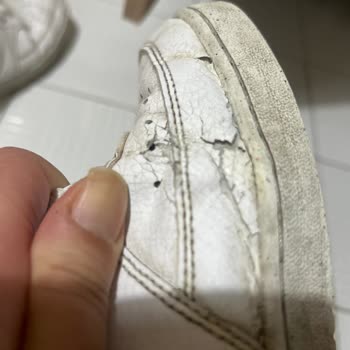 Nike Kullanıcı Hatası Denilen Ayakkabının Derisinin Dökülmesi