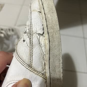 Nike Kullanıcı Hatası Denilen Ayakkabının Derisinin Dökülmesi
