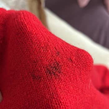 Trendyol H&M İş Bilmezliği Müşteri Mağduriyeti