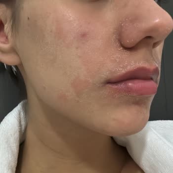 Birinci International Hastanesi Yakuplu Birinci Hastanesi