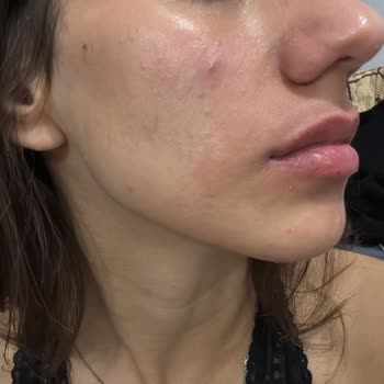 Birinci International Hastanesi Yakuplu Birinci Hastanesi