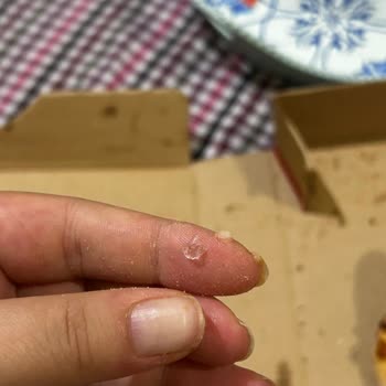 Terra Pizzadan Cam Çıktı