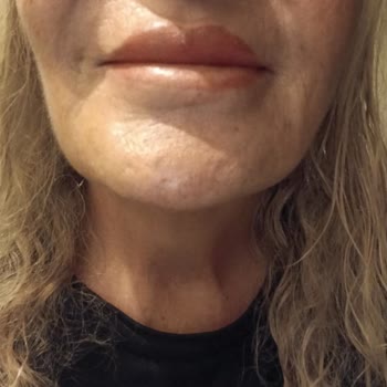 Refika Güzellik Merkezi Florya Dudak Renklendirme Deneyimi