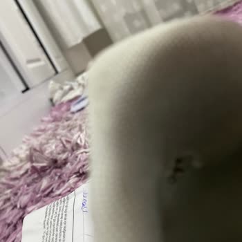 Nike Ayakkabısı Sağ Arka Kısımda Aşınma, Ayağa Kalıcı Zarar