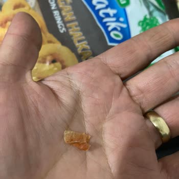 Torku Soğan Halkasından Soğan Kabuğu