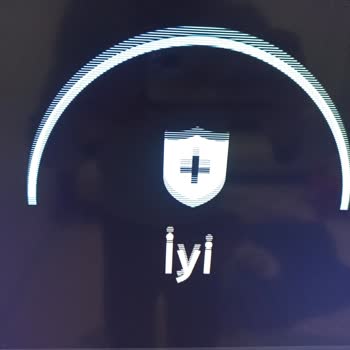 Samsung TV'deki Bitmek Bilmeyen Ekran Donmaları Ve Kaymaları