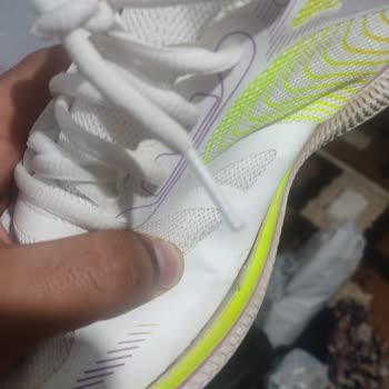 Skechers Marka Ayakkabı Altı 2. Giyişimde Açıldı