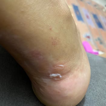 Adidas Samba W Ayakkabı Sorunu