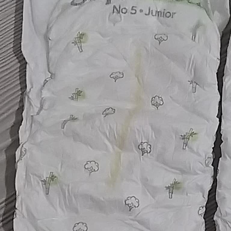 Sleepy Bez Sızdırma Ve Egzama Yaptı