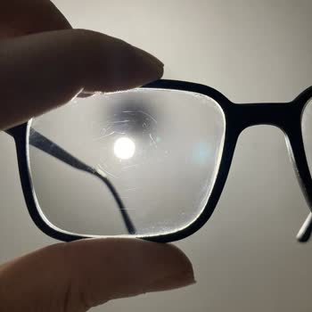 Atasun Optik Çizilmez Dediler, Çizildi: Mağduriyetimin Giderilmesini İstiyorum!