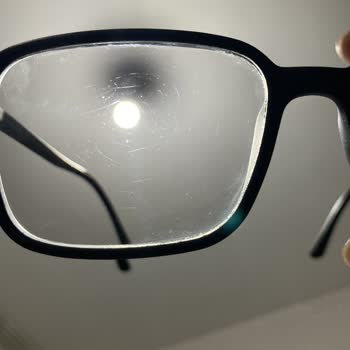 Atasun Optik Çizilmez Dediler, Çizildi: Mağduriyetimin Giderilmesini İstiyorum!