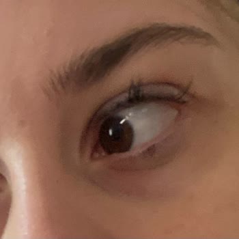 Vip Estetik Güzellik Özensiz İş Yapıyorlar