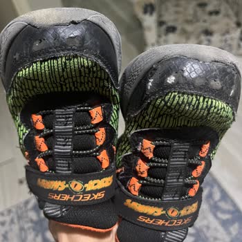 Skechers Markasının Ürününün Arkasında Durmaması