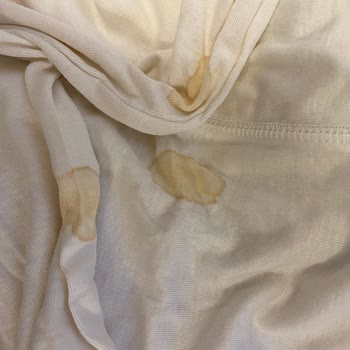 H&M Online Siparişimde Şeffaf Ambalaj İçerisinde Hasarlı Ürün Geldi