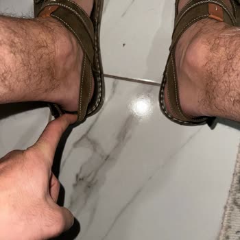 Derimod Sandaletin Cırtcırt Sorunu ve Müşteri Hizmetleri Cevabı